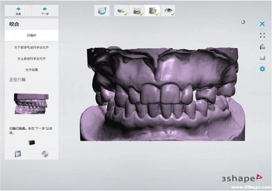 3Shape Dental System 2018 【操作方法】-可摘局部义齿